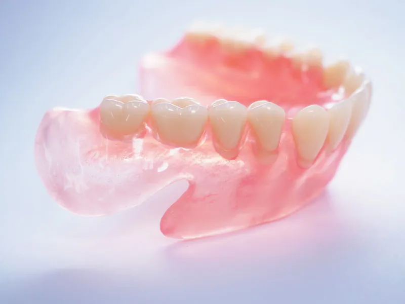 ノンクラスプ義歯（自費診療）