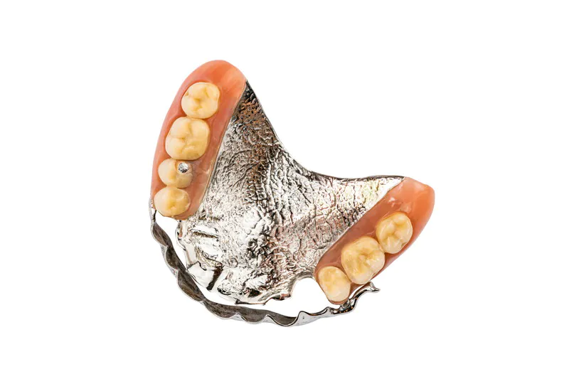 金属床義歯（自費診療）